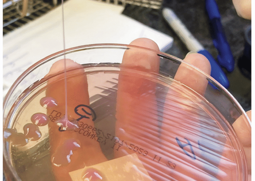 this may be the grossest eye pic