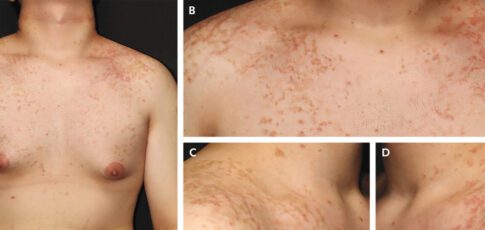 a weird itchy rash is linked to