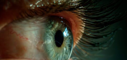 Tech News 4 bad sleep made woman s eyelids so