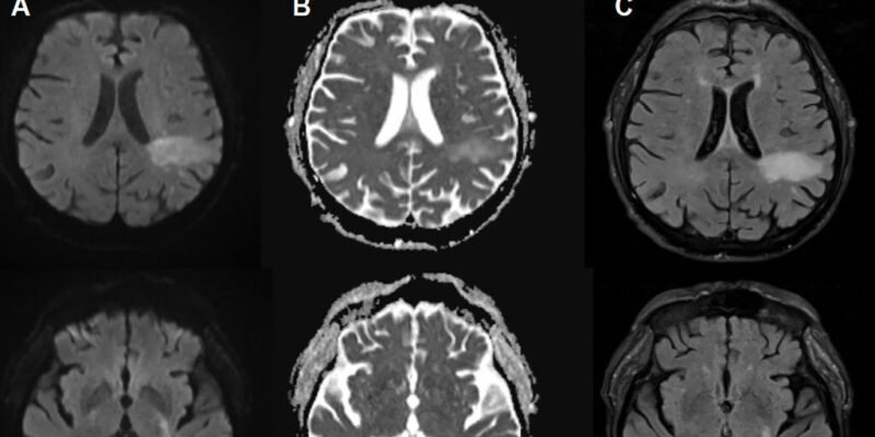 You're likely already infected with a brain-eating virus you've never heard of 12 you re likely already infected with a