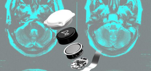 did neuralink make the wrong bet