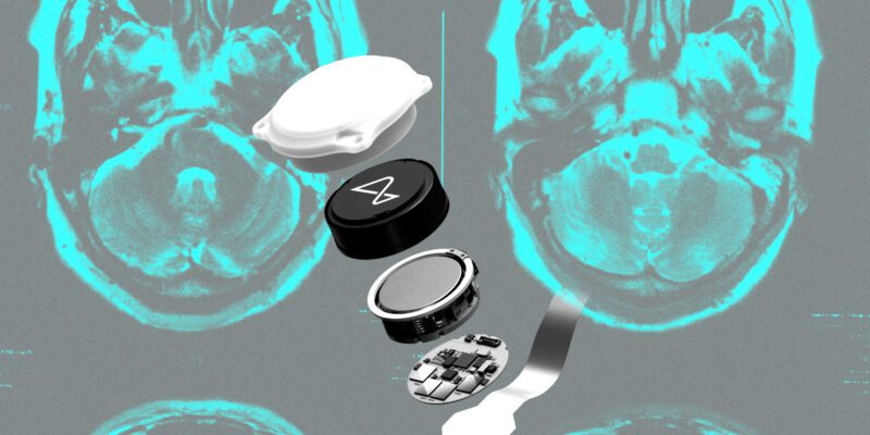Did Neuralink make the wrong bet? 1 did neuralink make the wrong bet