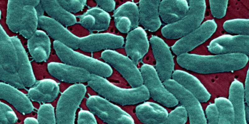 Flesh-eating bacteria devour man's arm and leg in just three days 8 flesh-eating bacteria devour man s arm and