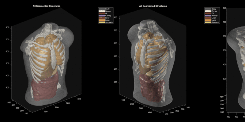 Midjourney goes from generating cat images to full-body ultrasound scans 3 midjourney goes from generating cat images to