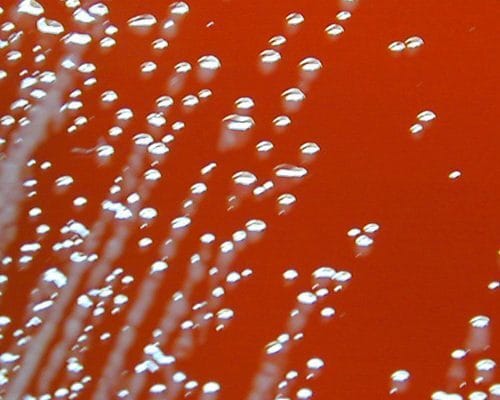 Two men fell gravely ill last year; their infections link to deaths in the ’80s 25 Two men fell gravely ill last year; their infections link to deaths in the ’80s