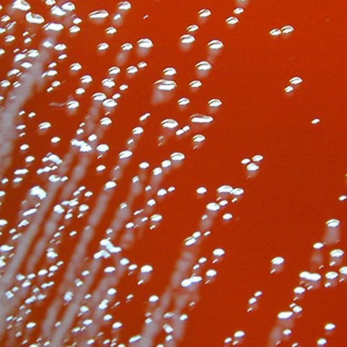 Two men fell gravely ill last year; their infections link to deaths in the ’80s