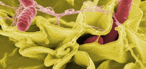 cdc slashed food safety surveillance now tracks