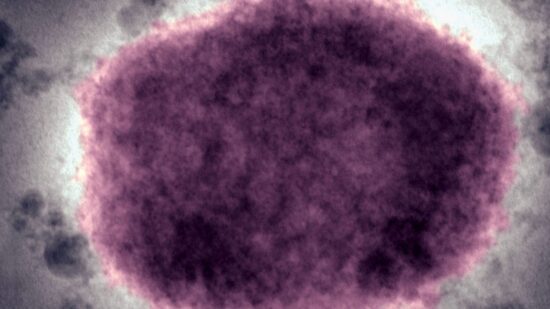 in 2022 the world axed a disease
