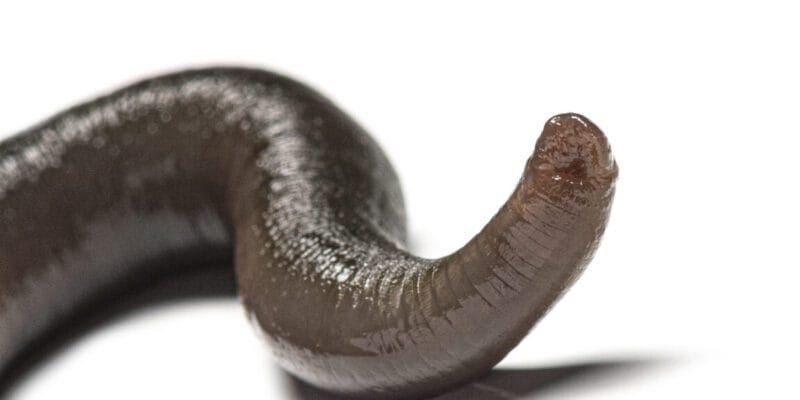 Man accidentally gets leech up his nose. It took 20 days to figure it out. 20 man accidentally gets leech up his nose