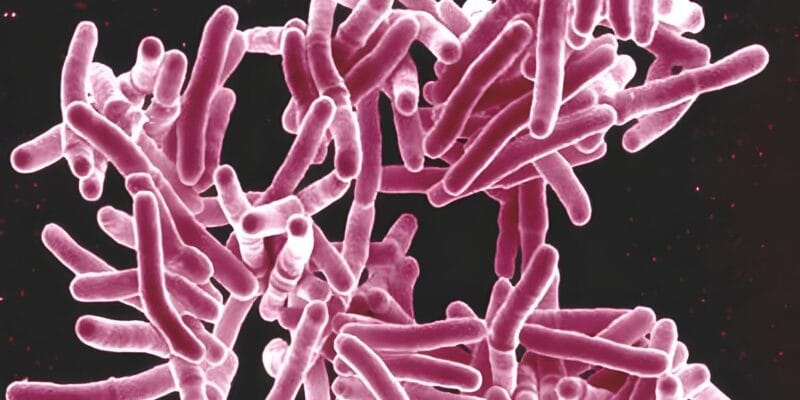 Why you don’t want to get tuberculosis on your penis 3 why you don t want to get