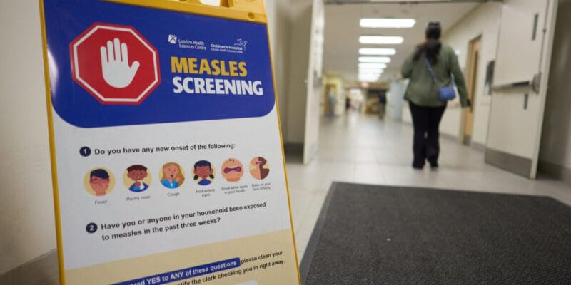 Canada fought measles and measles won; virus now endemic after 1998 elimination 8 canada fought measles and measles won virus