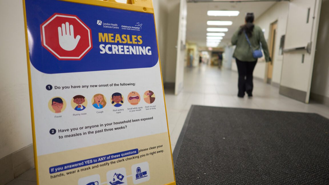 canada fought measles and measles won virus