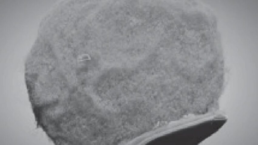 tiny chips hitch a ride on immune