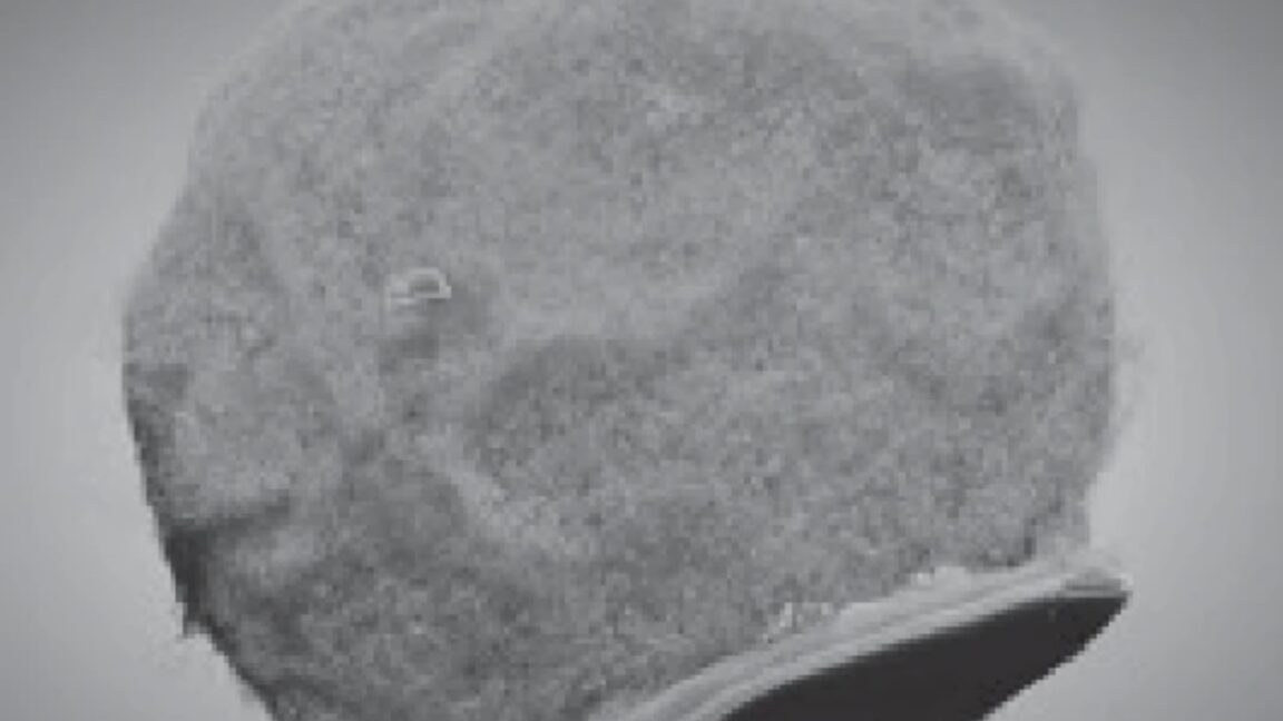 tiny chips hitch a ride on immune