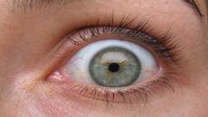 four-inch worm hatches in woman s forehead