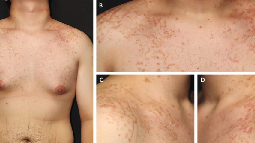 Tech News 8 a weird itchy rash is linked to