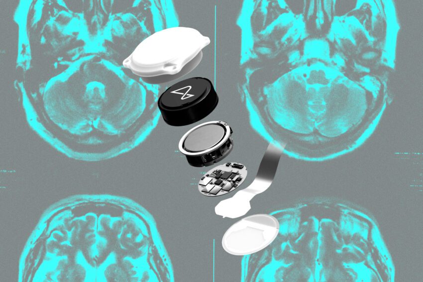 did neuralink make the wrong bet
