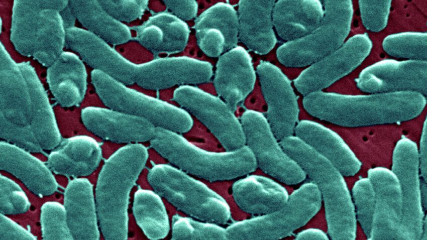 flesh-eating bacteria devour man s arm and