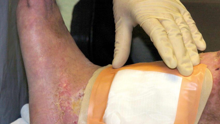 second carcass-eating fly species cleared by fda
